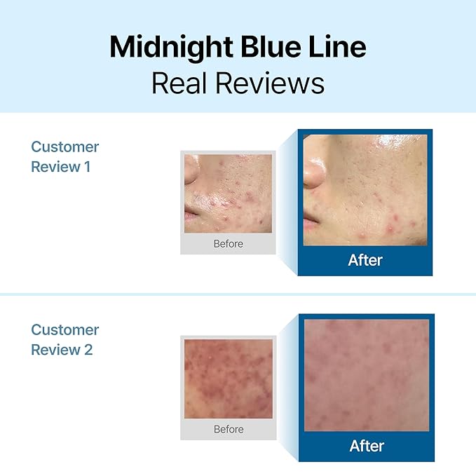 DearKlairs Midnight Blue Calming Cream, Soothing, Redness Relief Moisturizer, Hydrating, Fast Absorbing, Light Texture for Easy Use, For Oily Skin, Sensitive Skin Friendly (2 Ounce (Pack of 1))