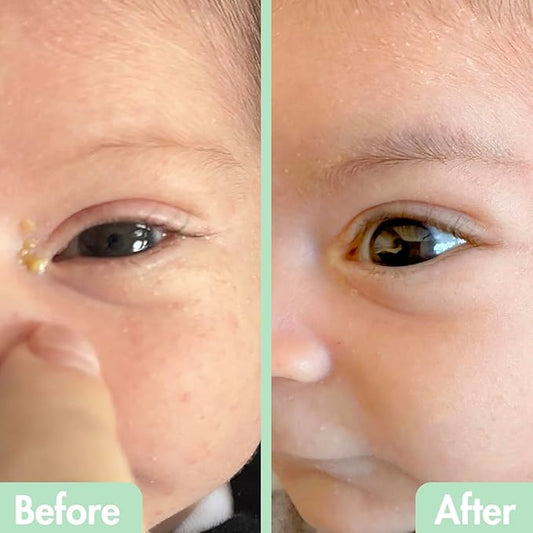 GlamBaby Eye Boogies Stye Eye Treatment | Sting-Free & Wipe-Free | Hypochlorous Eyelid Cleanser & Pink Eye Drops | Provides Allergy Conjunctivitis & Blepharitis Relief | Baby Eye Drops Spray (2 Pack)