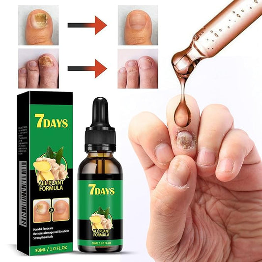 7 Days Nail Serum, Ginger Nail Serum, Ginger Nail Oil For Nail Care, Cuticle Oil, Nail Growth Serum, Ginger Nail Growth Oil, Nail Oil 2PCS