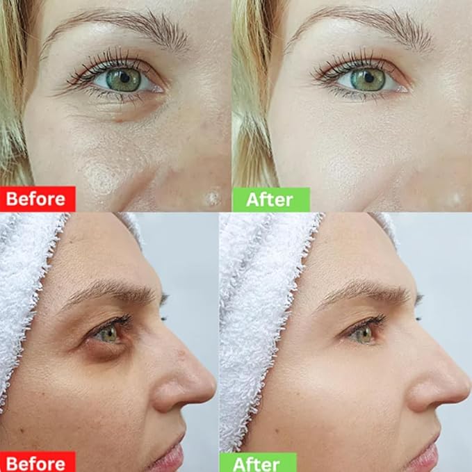 Naturals Instant Eye & Face Lift Cream Rapid Under Eye Bags Wrinkles Puffiness Remover for Women and Men in 60s -Temporary Firming & Tightening Treatment - Wrinkle Filler 30ml*2pcs