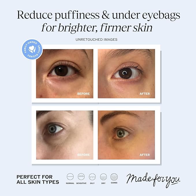 LilyAna Naturals Eye Cream for Dark Circles and Puffiness, Under Eye Cream for Wrinkles and Bags, Anti Aging Cream helps Improve Dryness; for Sensitive Skin 0.5 oz