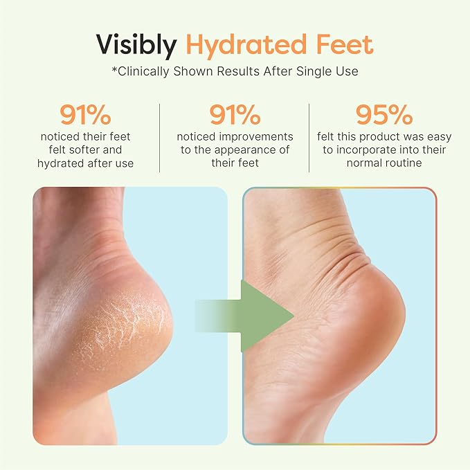 ZenToes Moisturizing Socks for Cracked Heel Treatment - Vitamin E, Olive Oil and Jojoba Oil Infused Heel Socks to Soften and Hydrate (Blue & White Stripes, Regular)
