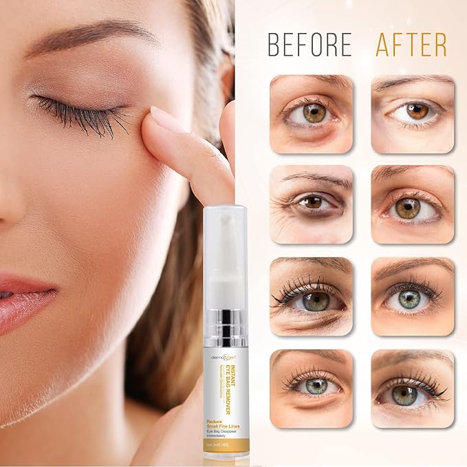 Instant Eye Cream Duo – Lightweight Formula for Hydrating & Refreshing Under-Eye Area, Reducing the Appearance of Puffiness & Dark Circles.