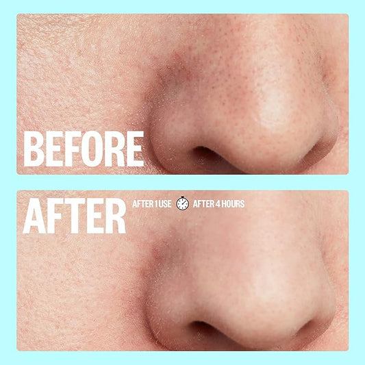 PEACE OUT Skincare Pore Minimizing Strips, Hydrocolloid Pore-Refining Nose and Face Strips with Retinol & Vitamin A to Shrink Enlarged Pores and Remove Blackheads (4 pore and 4 nose strips)