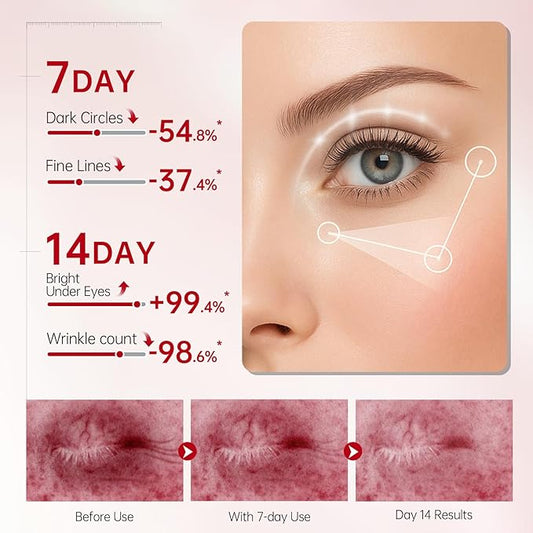 Peunitory Eye Balm, Under Eye Cream Brightener Balm Stick For Wrinkles Dark Circle Treatment Moisturizing Relief Skin Elasticity 0.32oz/9g