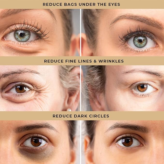 Instant Firm Eye Tightening Cream: Temporary Under Eye Bag Puffiness Removal - Rapid Eyebags Tightener Reducer Treatment for Senior Men and Women, 30mL
