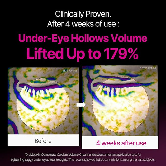 CEMENRETE EYE CREAM