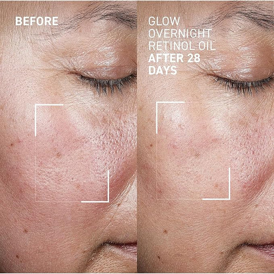 Dr. Brandt Bright This Way Glow Overnight Retinol Oil - Pure 2% Retinol Improves Wrinkles, Lines & Skin Texture - 1 fl oz